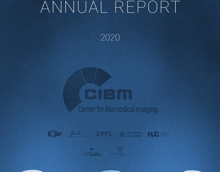 Martel has supported CIBM the Center for Biomedical Imaging publication of the CIBM’s Annual Report 2020